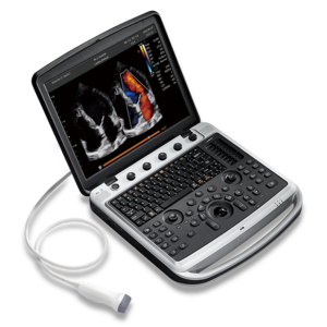 SonoBook 9, SonoBook 9 chison, chison